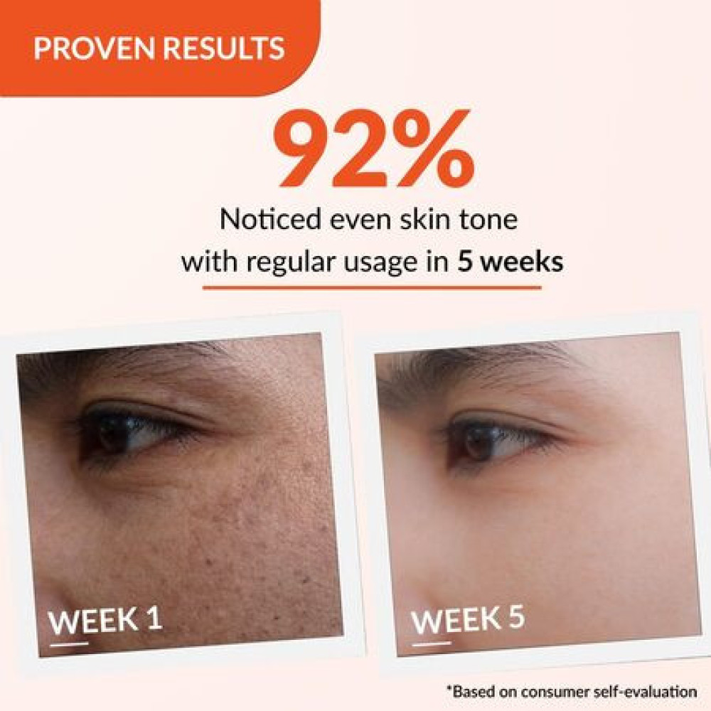 Fixderma Tranexamic Acid + 2% Kojic Acid + 1% Arbutin SKARFIX -TX Face Cream | Pigmentation Removal Cream | Kojic Acid | Uneven Skin Tone - 15 gm