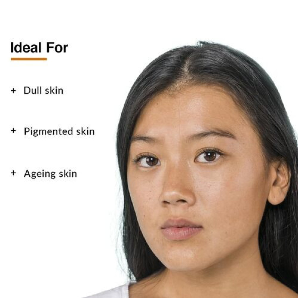 Fixderma 17% Vitamin C Face Serum for Glowing Skin | Retinol | Skin Brightening Vit C Serum for Women and Men | Anti Aging Night | Niacinamide - 30 G