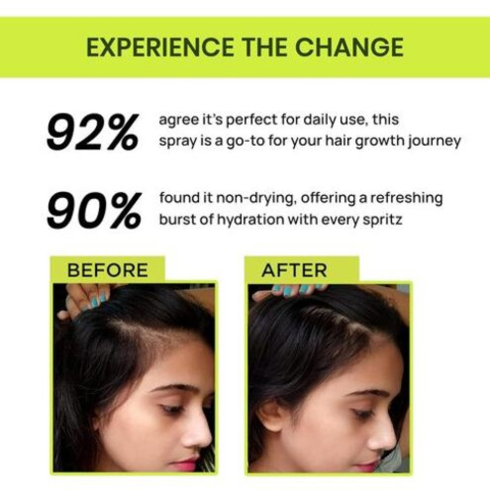 {"en":"Alps Goodness Rosemary Water Spray For Hair Growth (100 ml) | Hair Spray for Regrowth | Rosemary Mist | Adds Shine | Helps Reduce Hairfall | Strengthens Hair | Suitable For All Hair Ty